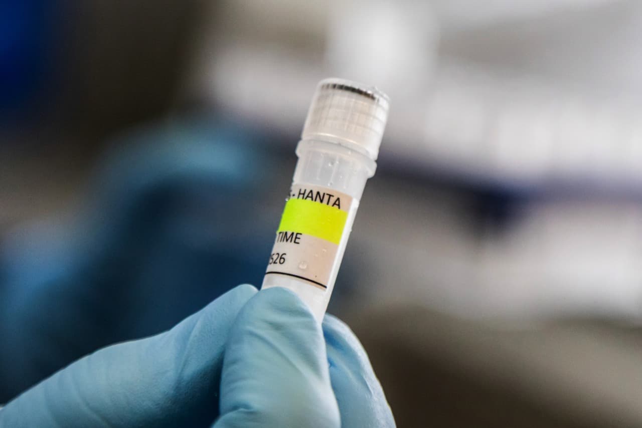 The Next Frontier for Hantavirus: Finding Vaccines and Treatments