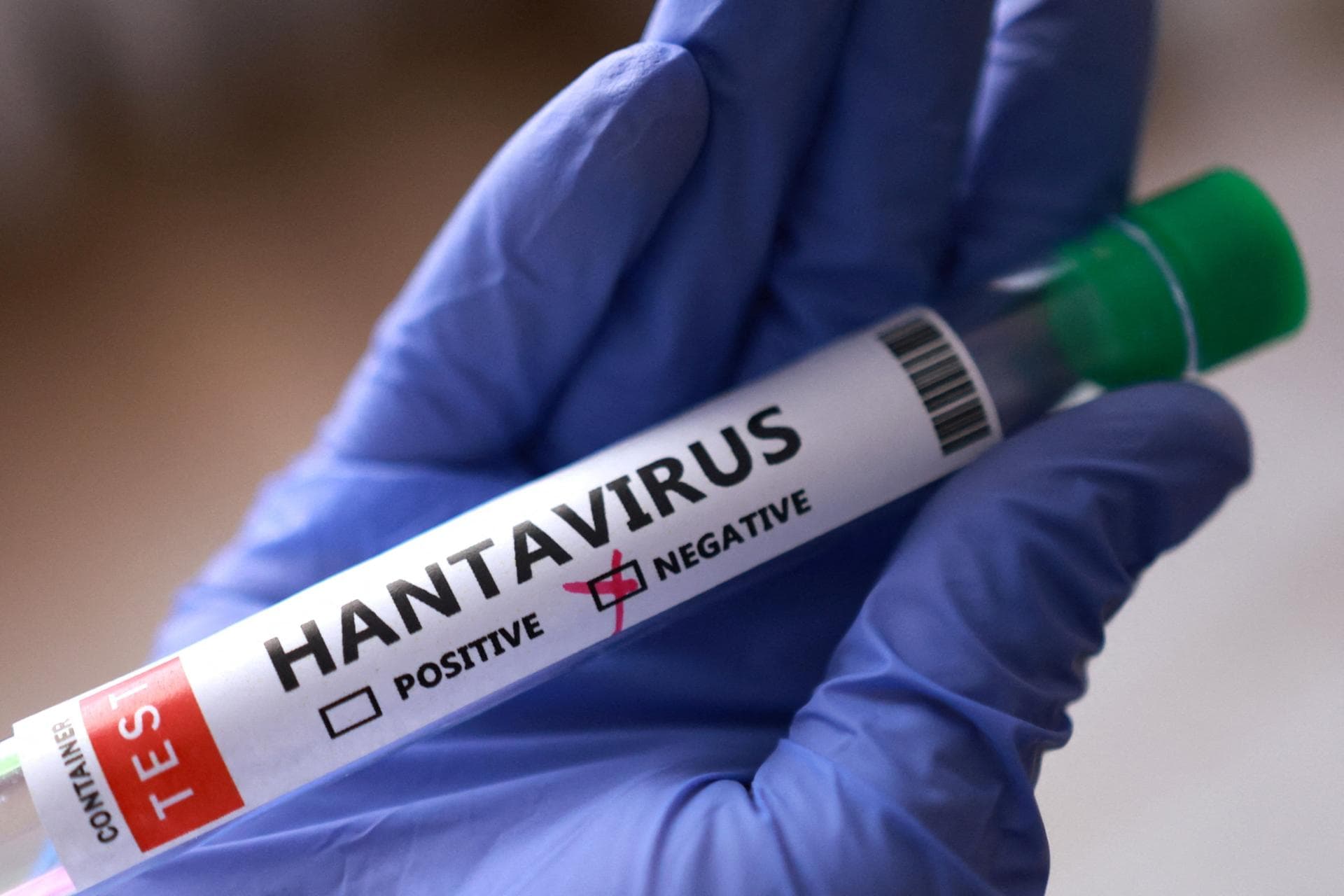 Health officials track dozens who left hantavirus-stricken ship after 1st fatality
