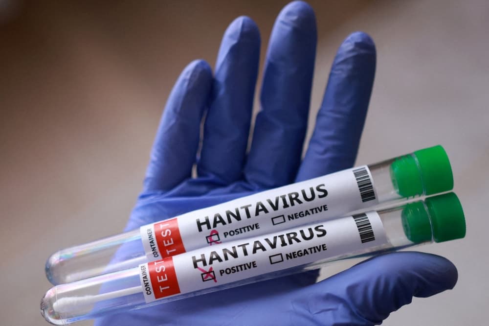 MOH may add hantavirus tracker to MySejahtera if needed, says deputy minister