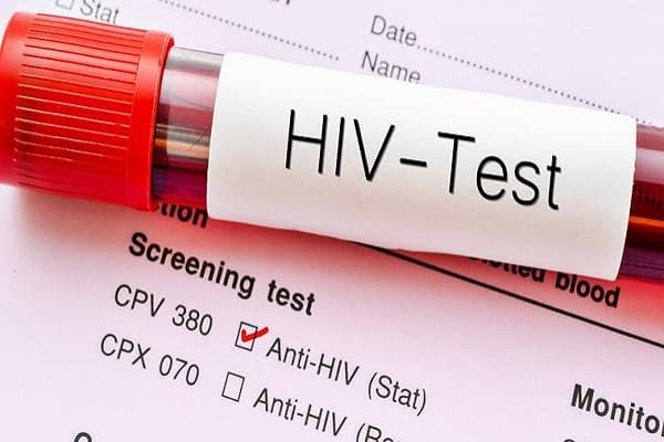 Stakeholders leverage social media to reduce HIV infections among young people