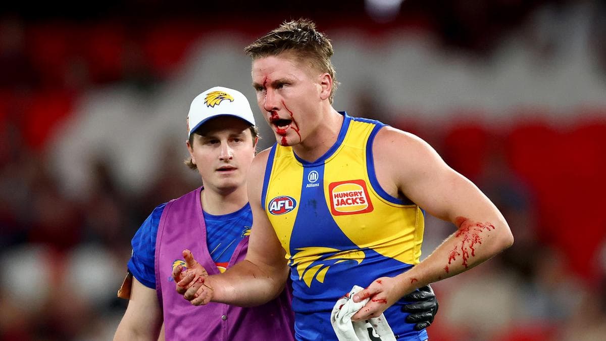 West Coast Eagles confirm defender Harry Edwards has suffered another concussion in game against Melbourne