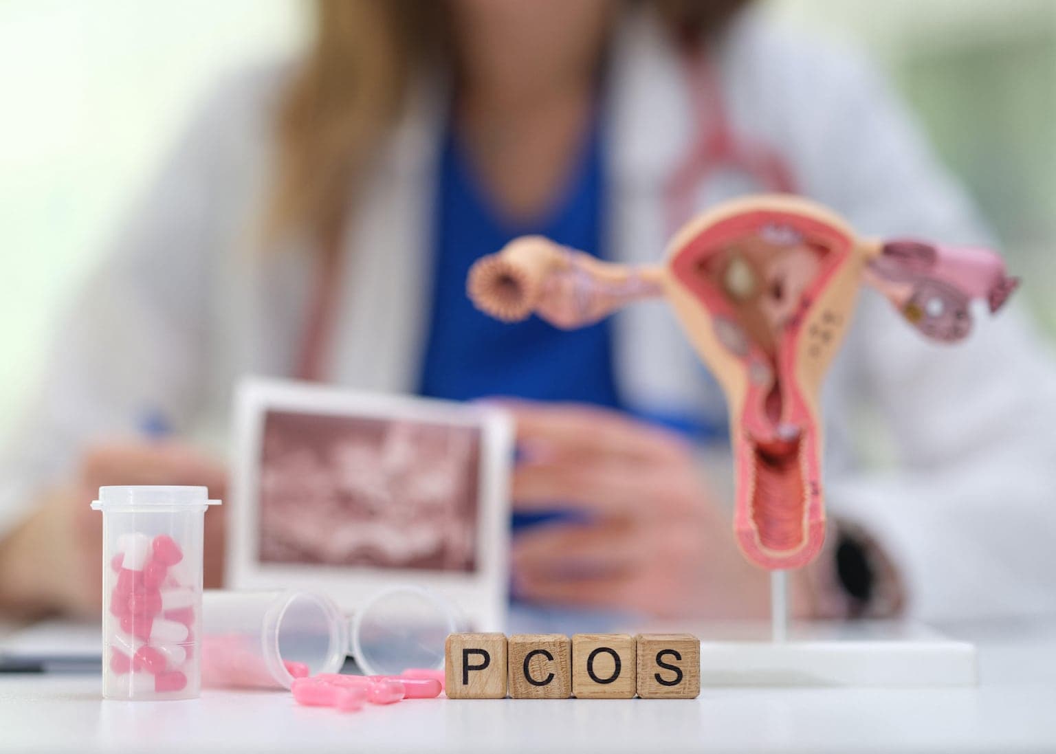 6 early signs of PCOS that are often overlooked