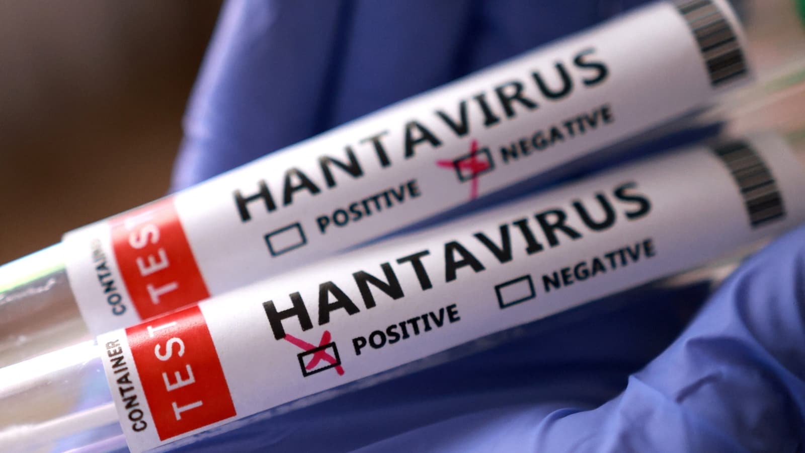 US national tests positive for Hantavirus, another shows mild symptoms after leaving cruise ship